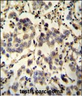 Rabbit Polyclonal Antibody to C6orf58