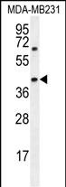 Rabbit Polyclonal Antibody to AMACR