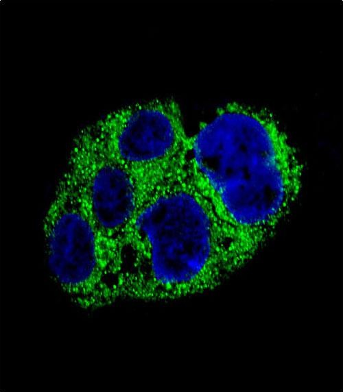 Rabbit Polyclonal Antibody to AMACR
