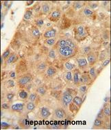 Rabbit Polyclonal Antibody to AMACR