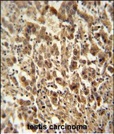 Rabbit Polyclonal Antibody to DIS3