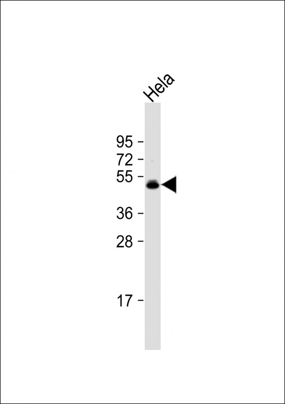 CEPT1 (N-term)