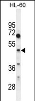 Rabbit Polyclonal Antibody to CEPT1 (N-term)