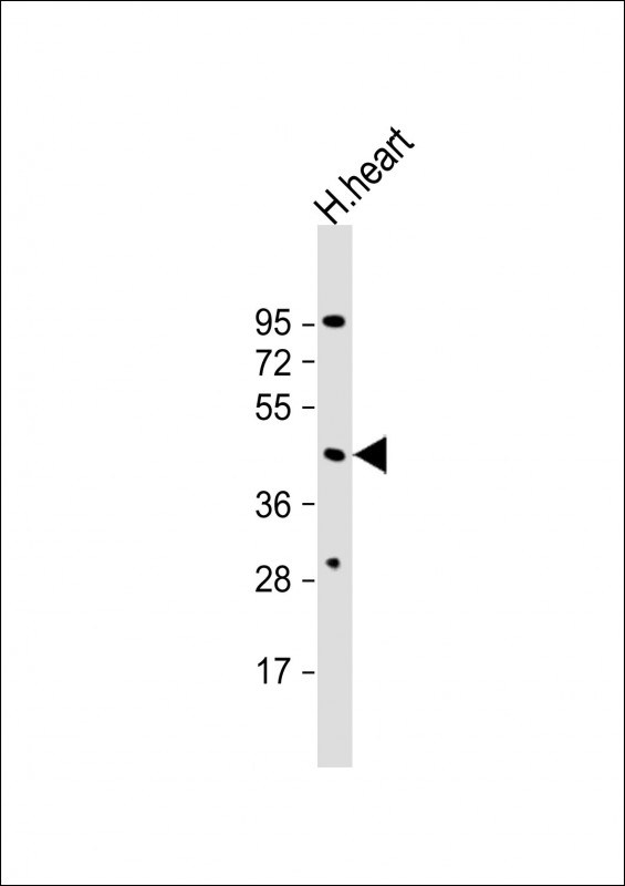 JMJD6 (PTDSR) (N-term)