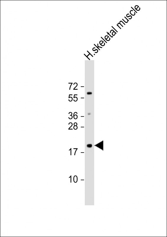 IMMP1L