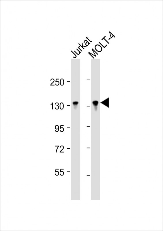 BCL11B