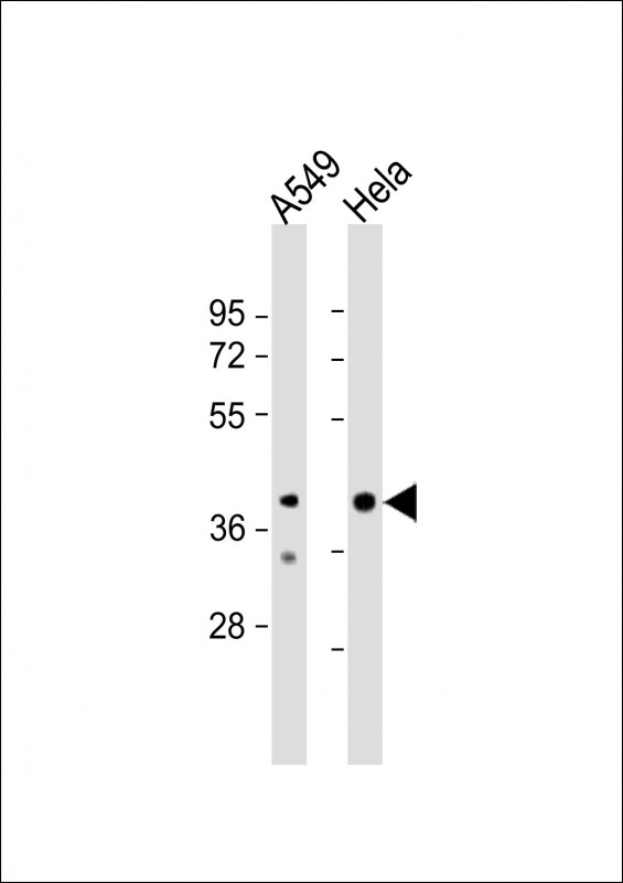 JMJD5 (N-term)