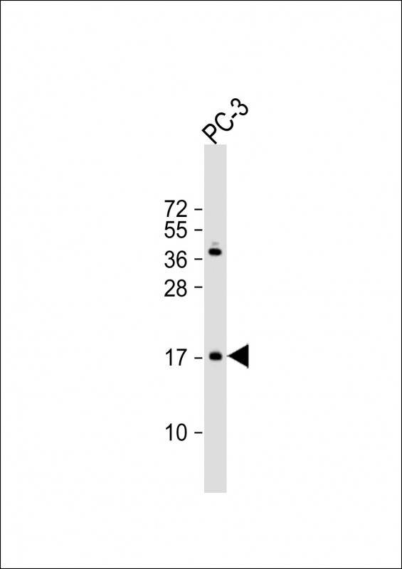 NDUF3 (N-term)