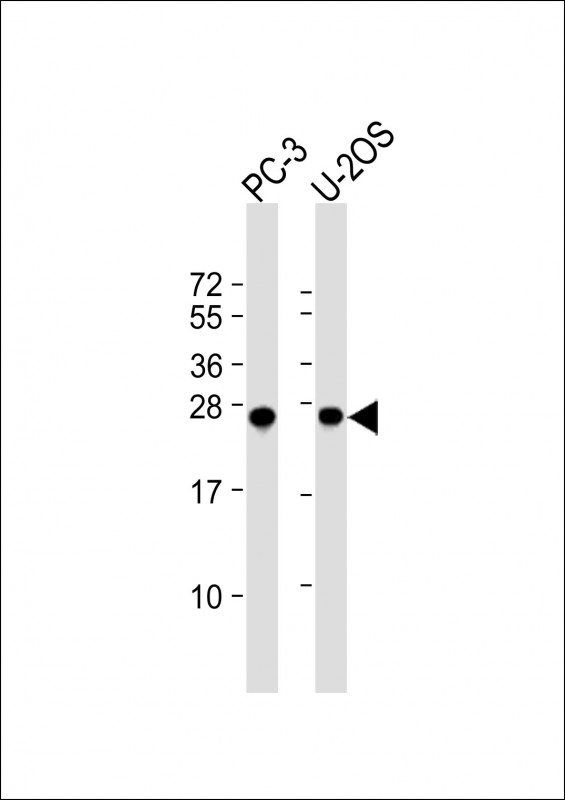 ZCCHC17