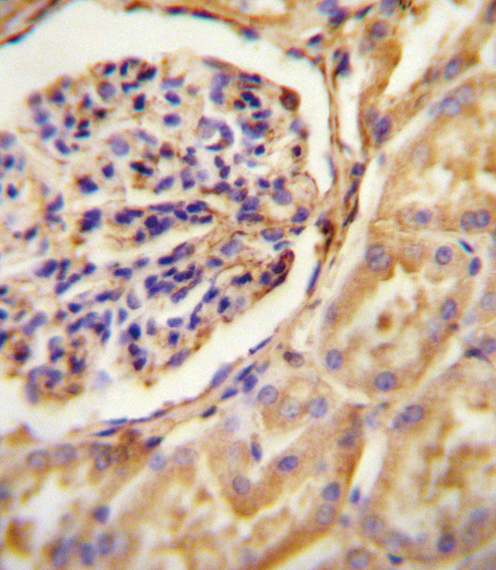 Rabbit Polyclonal Antibody to GNAT2