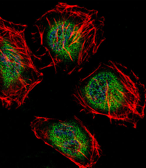 Rabbit Polyclonal Antibody to CAF-1 (N-term)