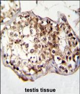 Rabbit Polyclonal Antibody to CAF-1 (N-term)