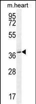 Rabbit Polyclonal Antibody to NAT12