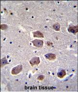 Rabbit Polyclonal Antibody to NAT12