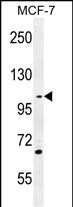Rabbit Polyclonal Antibody to GAS2L2