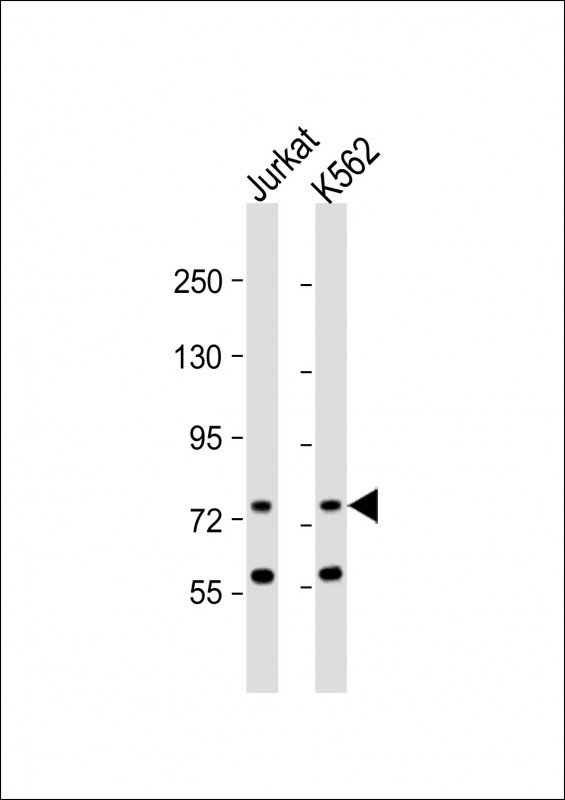ATG16L2 (Center K292)