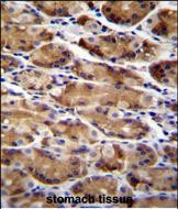 Rabbit Polyclonal Antibody to ATG16L2 (Center K292)