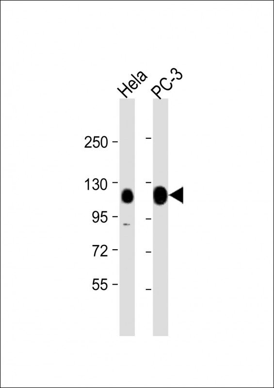 TRIM28 (N-term)