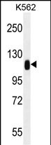 Rabbit Polyclonal Antibody to TRIM28 (N-term)