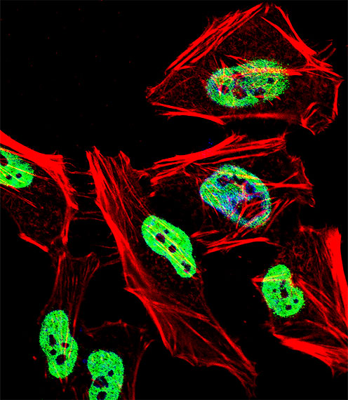 Rabbit Polyclonal Antibody to TRIM28 (N-term)