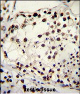 Rabbit Polyclonal Antibody to TRIM28 (N-term)
