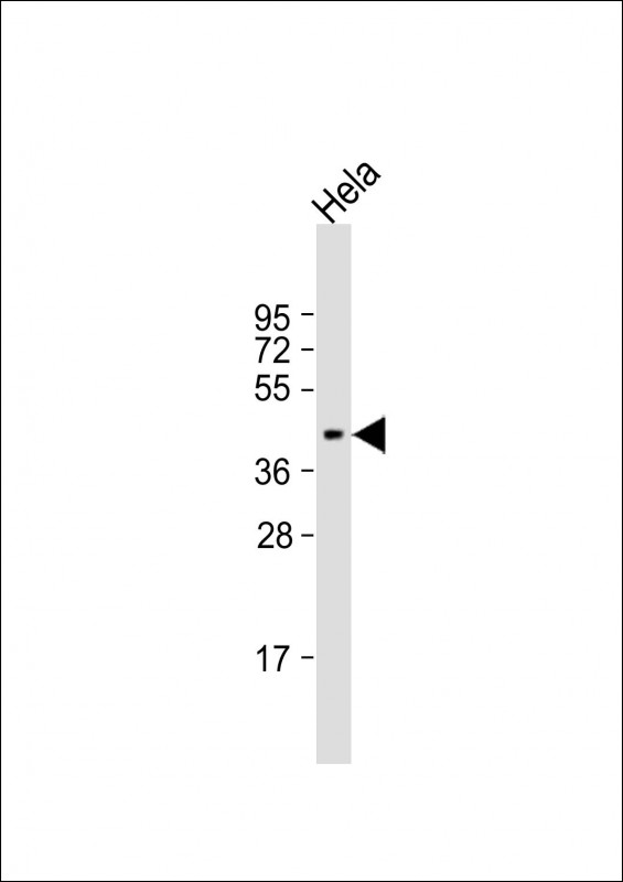 NUDT9