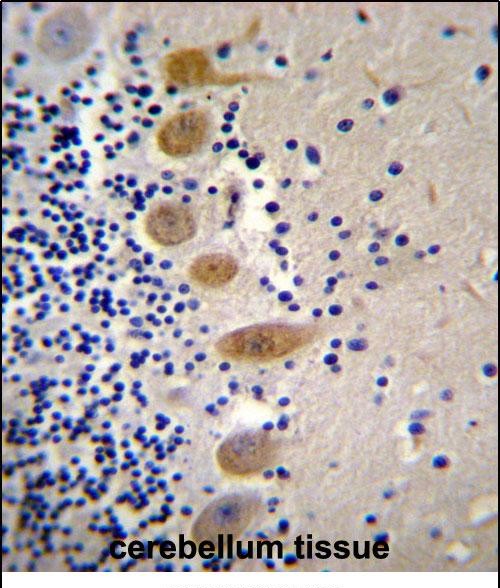 Rabbit Polyclonal Antibody to MST1