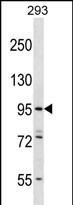 Rabbit Polyclonal Antibody to ESPNL
