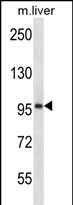 Rabbit Polyclonal Antibody to ESPNL