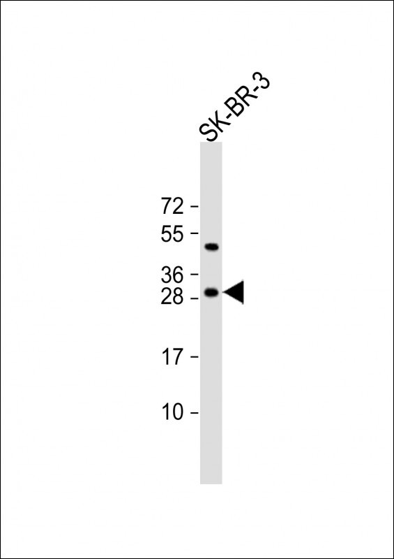 CSN2 (N-term)