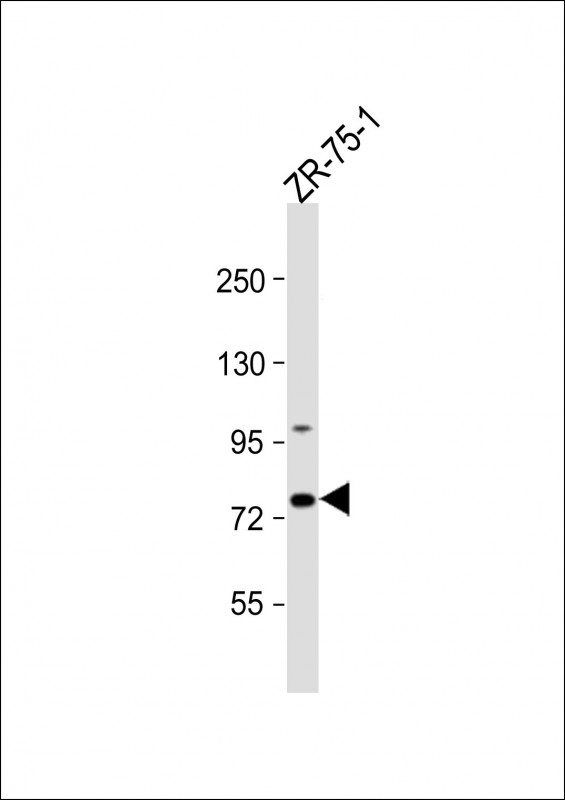 CTTNBP2NL (N-term)