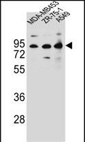 Rabbit Polyclonal Antibody to CTTNBP2NL (N-term)