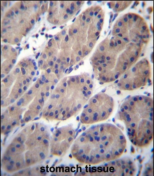 Rabbit Polyclonal Antibody to CTTNBP2NL (N-term)
