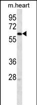 Rabbit Polyclonal Antibody to LINGO4