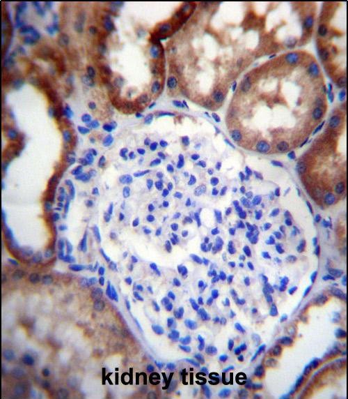 Rabbit Polyclonal Antibody to LINGO4