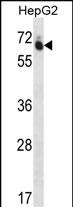 Rabbit Polyclonal Antibody to GUF1 (N-term)