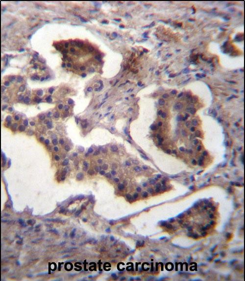 Rabbit Polyclonal Antibody to GUF1 (N-term)