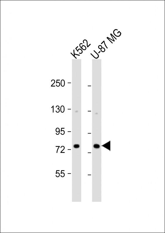 ARHGAP22