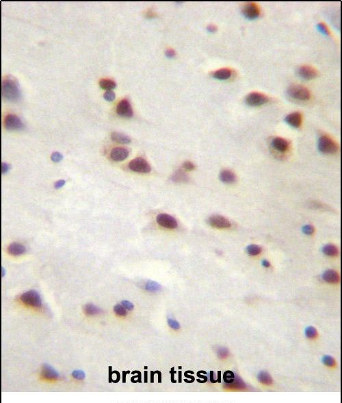 Rabbit Polyclonal Antibody to ANKRD6