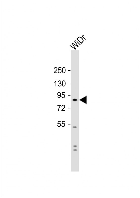 SUSD2