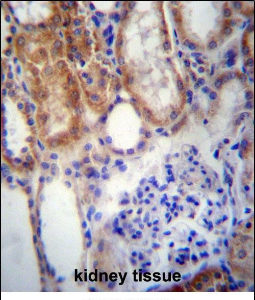 Rabbit Polyclonal Antibody to SUSD2