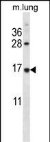 Rabbit Polyclonal Antibody to RPL27