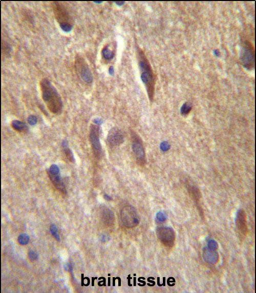 Rabbit Polyclonal Antibody to FGF11 (N-term)