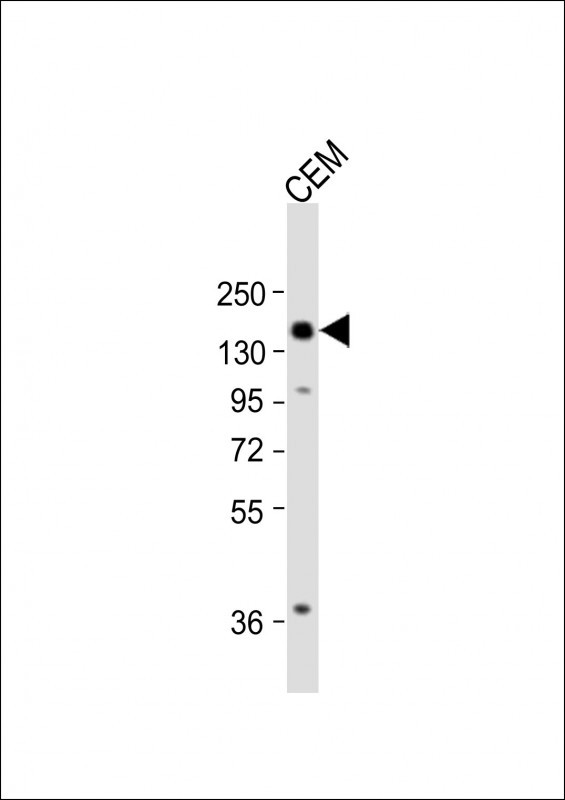 Rabbit Polyclonal Antibody to ATG2B (N-term)