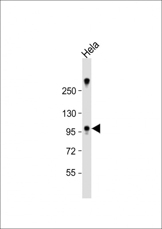 ZCCHC14