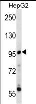 Rabbit Polyclonal Antibody to PPP1R3F