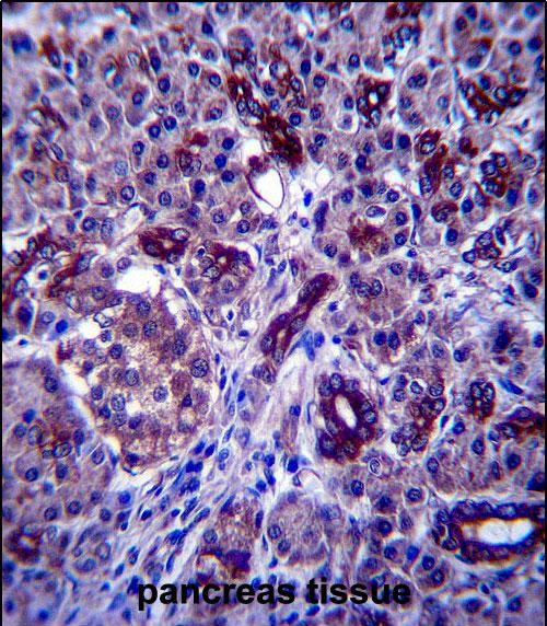 Rabbit Polyclonal Antibody to PPP1R3F