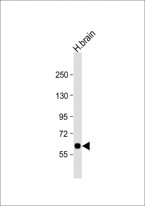 SLC2A13
