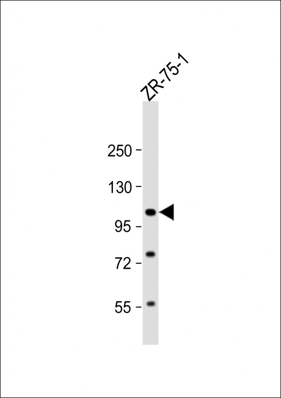FOLH1 (N-term)