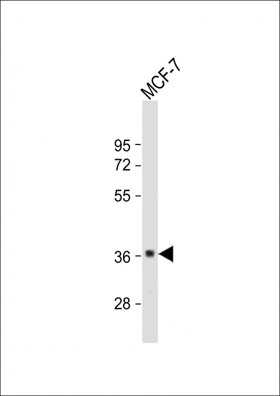 GDPD3 (N-term)